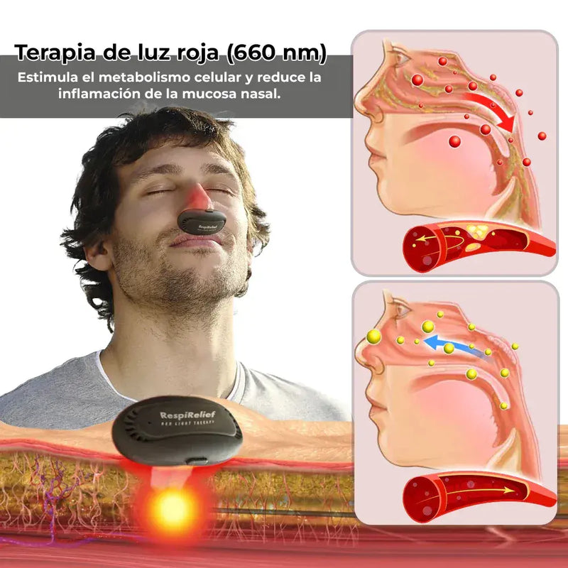 RespiRelief™ Dispositivo de terapia nasal con luz roja